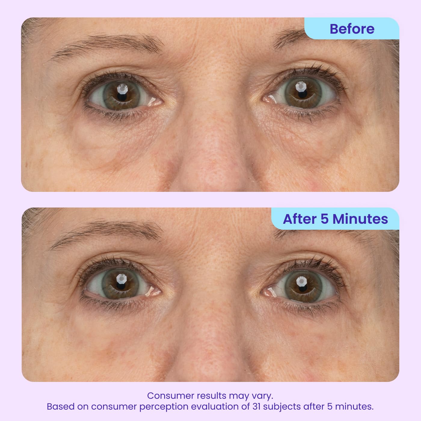 Celestias Instant Lift Eye Gel
