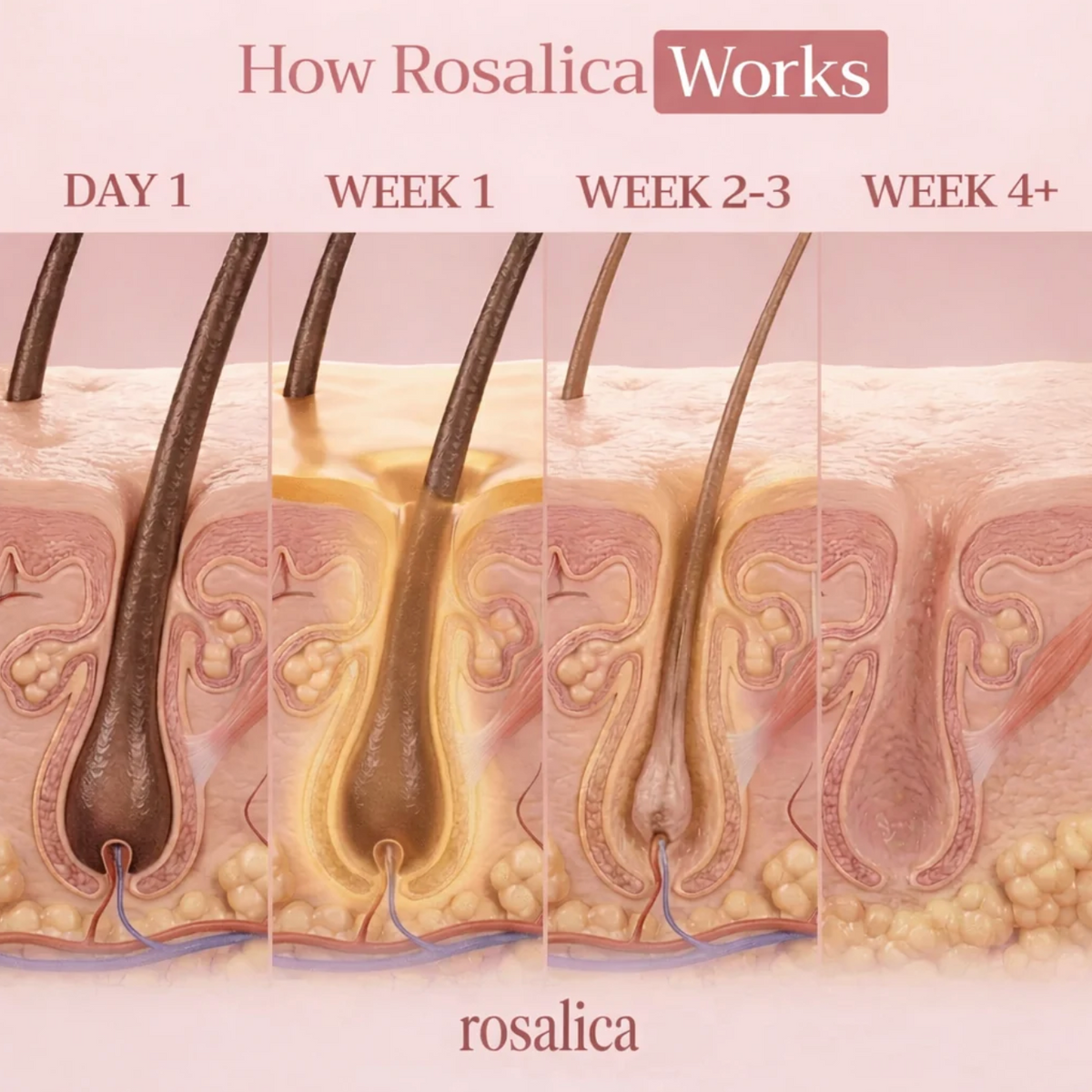 Celestias - PCOS Cyperus Rotundus Oil